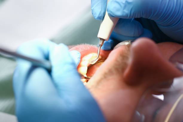 Best Emergency Dental Surgery in Winston Salem, NC