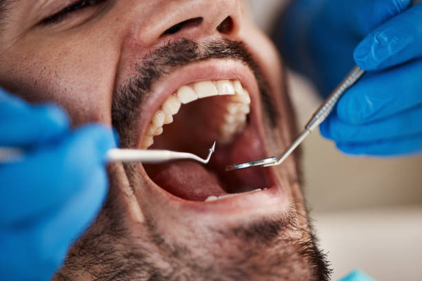 Best Pediatric Emergency Dentist in Winston Salem, NC